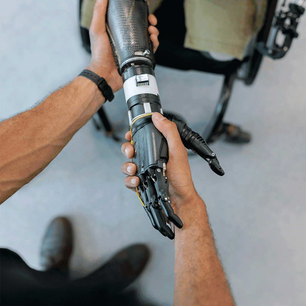 artificial arm fitting