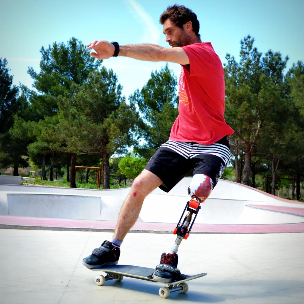 transtibial prosthesis Murfreesboro TN